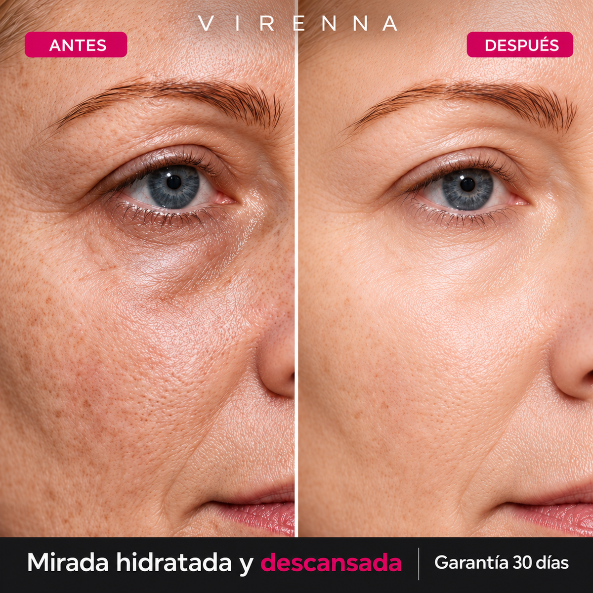 Virenna Serum Ojeras — Contorno de Ojos Anti-Fatiga y Anti-Ojeras